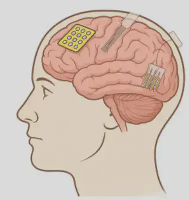 Neural Interfaces